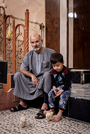 Abdul Hakeem Abdullah Hamash al-Aqeedi, who lost an eye and had a plate put into his left leg after strikes on Mosul on February 25, 2017. (Image by the New York Times)