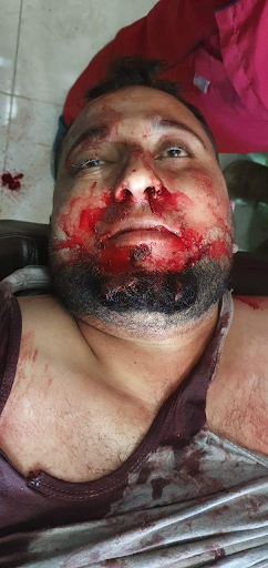 A victim of the missile attack on Al-Bab on February 2nd 2022 (Image via Mahmoud Al Ahmad / Facebook)