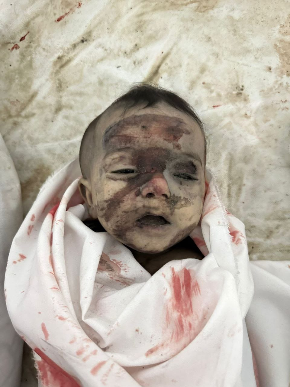 Source: Palestine pediatric patients service page