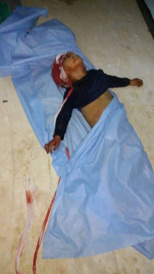 GRAPHIC Child victim of an alleged Russian airstrike at (via Jaish )