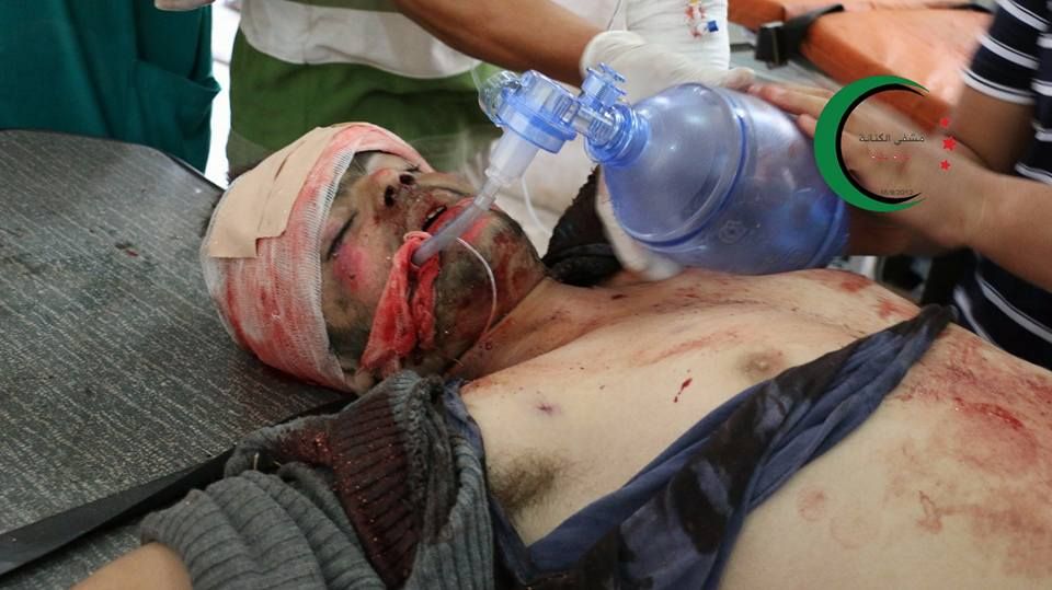 Victim of alleged Russian airstrike on Dara Ezzat, Oct 13th 2015 (via al Kanana Hospital)