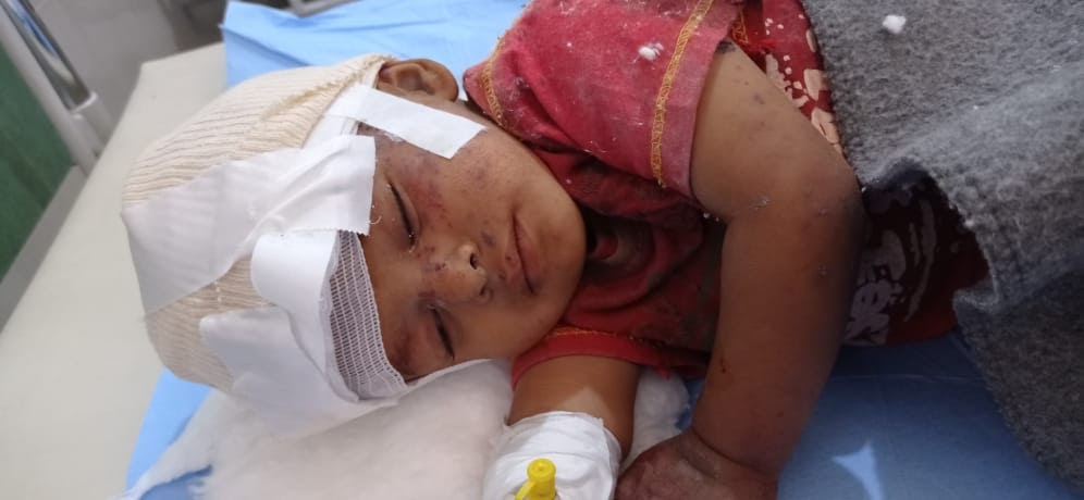 One year old girl wounded by alleged Turkish shelling of Ain Issa on July 4, 2021. (Image posted by North Press Agency)