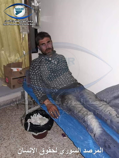 One of the civilians injured in the attack (via SOHR)