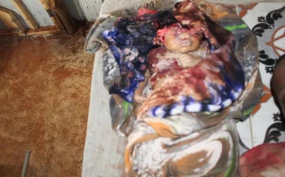 Graphic photograph of a 20-month old baby, killed in a reported US airstrike on Kunyo Barrow on February 24th 2019 (via Horn News)