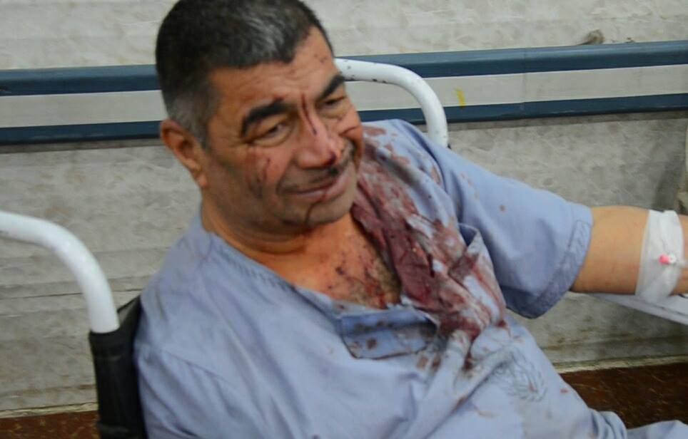 Hospitalised victim of alleged coalition airstrike near Mosul, April 20 2015 (Hunaa 