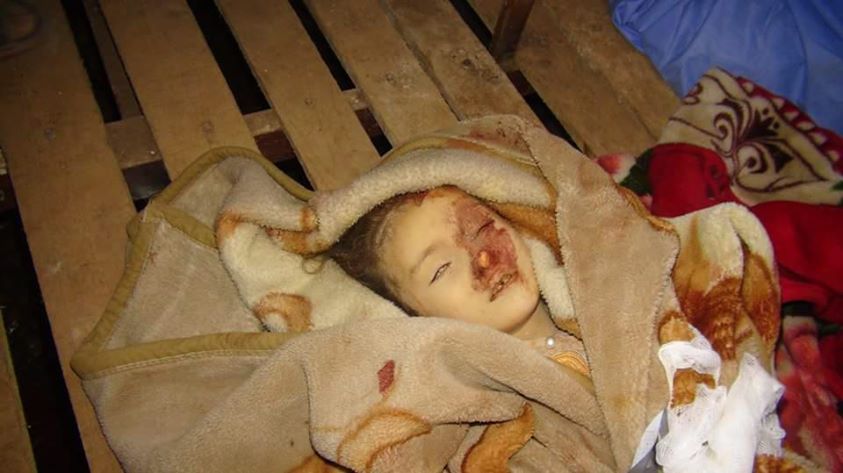 GRAPHIC: One of children killed in an alleged Russian strike at , Oct 1st 2015 (via SN4HR)