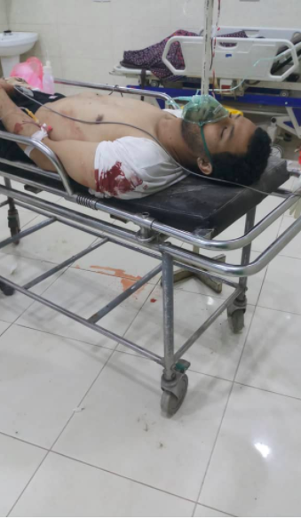 One source, @YemeniFatima, indicated that Al-Maliki survived the strike, but had his leg amputated in hospital (@YemeniFatima, May 14th 2020)