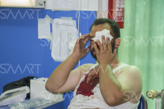 A wounded man is treated in a clinic for injuries sustained during an alleged attack by Russian warplanes (via Smart)