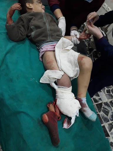 Most of those killed and injured in the alleged Turkish strike on Tal Rifaat, Dec 2nd 2019, are children (via SOHR).