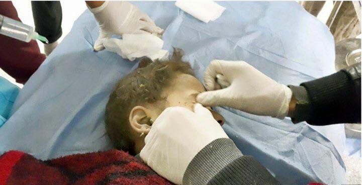 Child victim of reported Coalition strike at Ramadi December 3rd 2015 (via Al Anbar Motny)