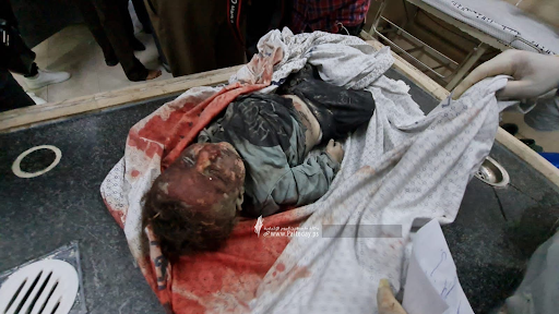Very graphic image of a child allegedly killed in strikes on Al Jeniya neighborhood on May 13, 2021. (Image posted by Paltoday News)