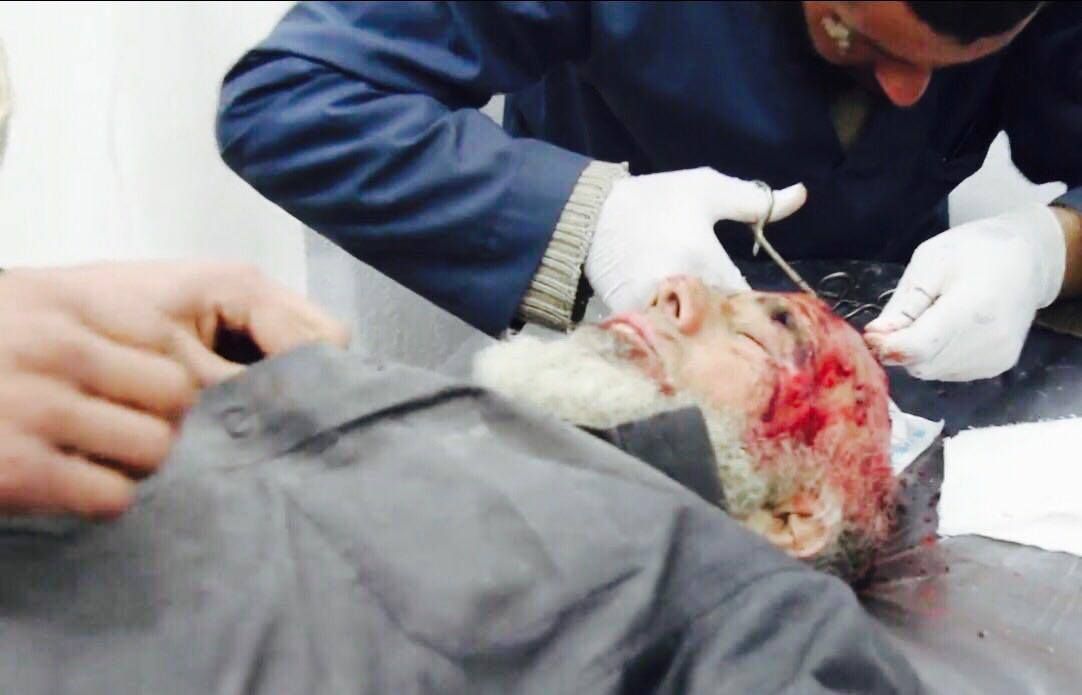 GRAPHIC: A wounded man is treated for a head injury following an alleged Coalition raid on Al Tabaqa, March 19th (via Shariya Voice)