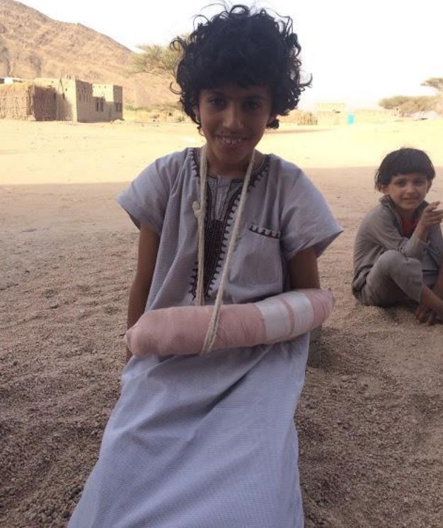 Othman Mohammed Saleh Al Athal, 12, injured during the May 23, 2017 raid in Marib governorate, Yemen. Photo taken by a Mwatana researcher on June 16, 2017