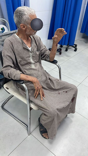 Civilian injured by clashes between militias in Ain Zara on May 29, 2023. (Image posted by Ambulance Services Libya via Facebook)