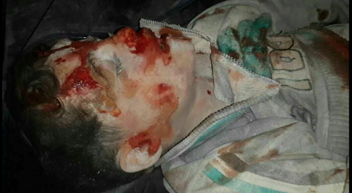 Allegedly child victim of the massive aerial shelling at al-Quds