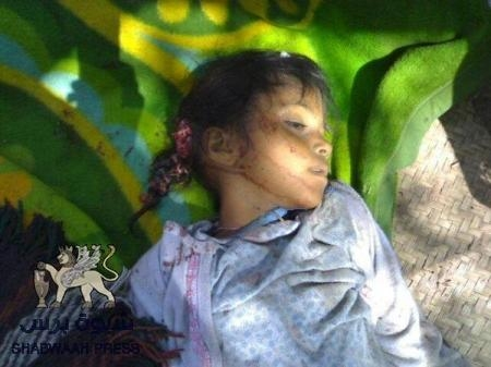 A number of children reportedly died from their injuries while on their way to hospital (Shabwa Press, December 17th 2014)