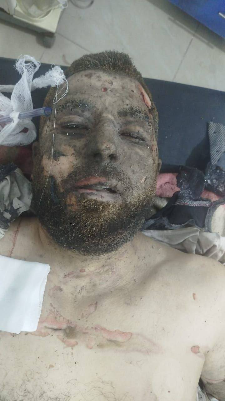اخـــو السمـــــره