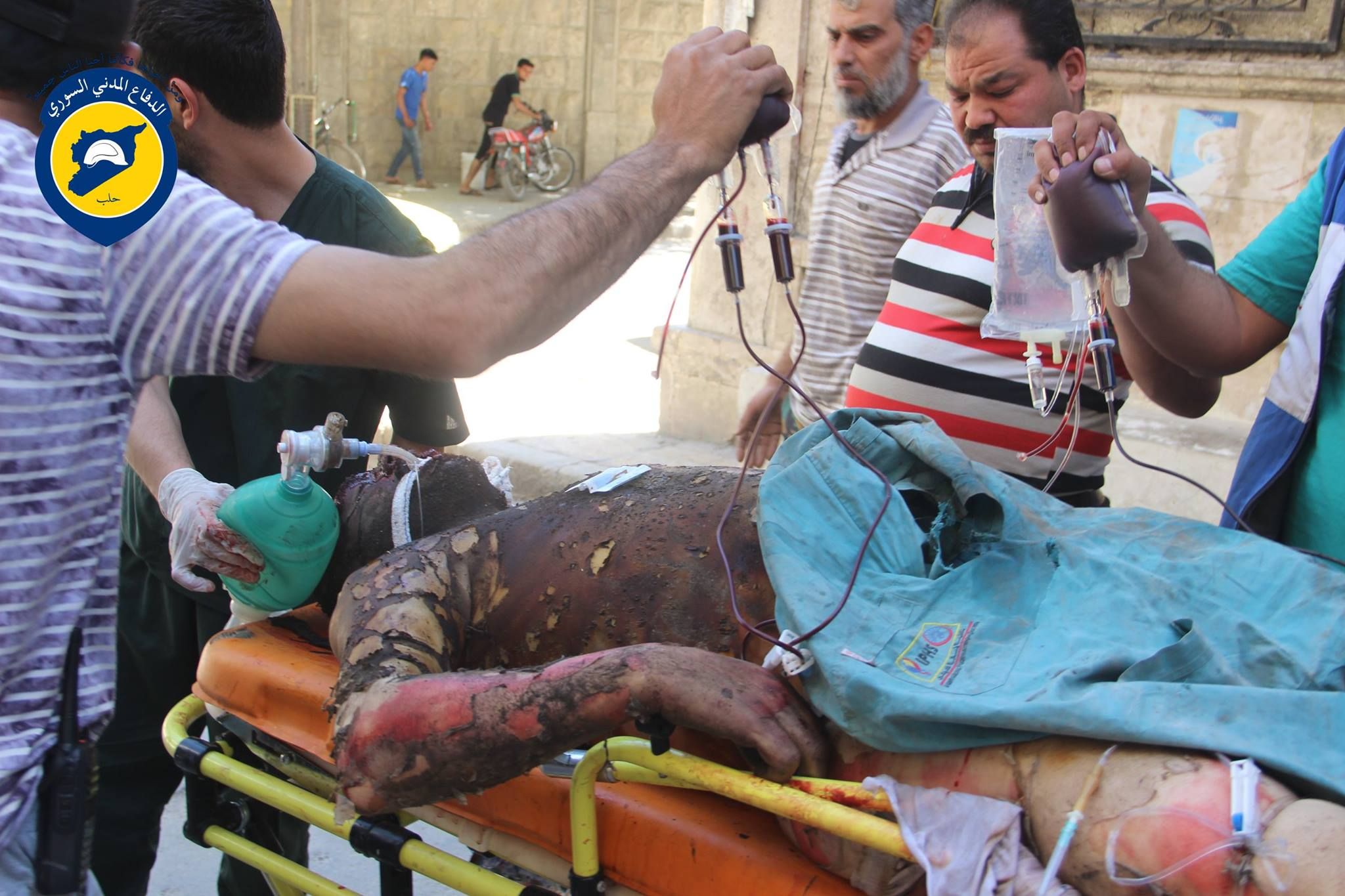 A victim is treated following an airstrike on Aleppo, April 22nd. (via White Helmets)