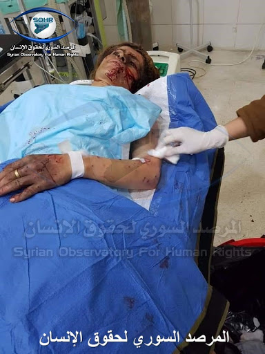 One of the civilians injured in the attack (via SOHR)