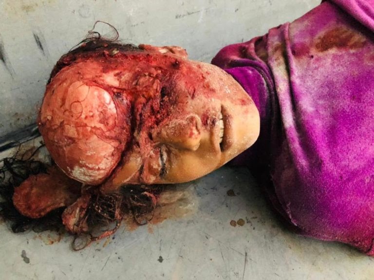 Very graphic image of the children killed in alleged Turkish strikes on Ain Issa on July 4, 2021. (Image posted by the Syrian Democratic Forces)