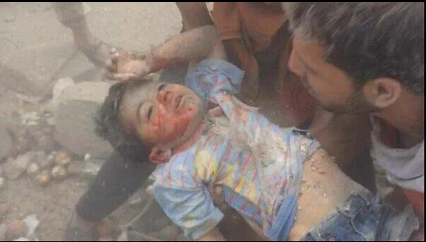 Allegedly child victim of the massive aerial shelling at al-Quds