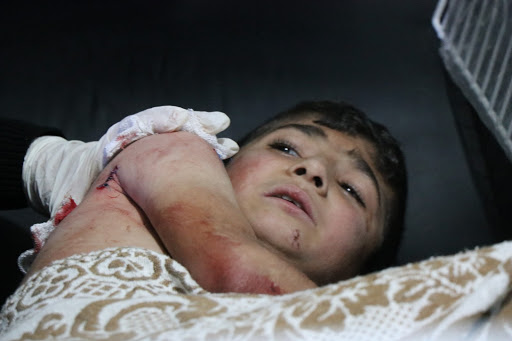 A child injured in an alleged Turkish attack on Tal Rifaat. Dec 2nd 2019 (via ANHA)