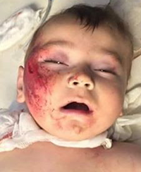 Ahmad Hamze Layla, aged one, killed in an alleged Russian airstrike on Anadan, Dec 9th (via VDC)