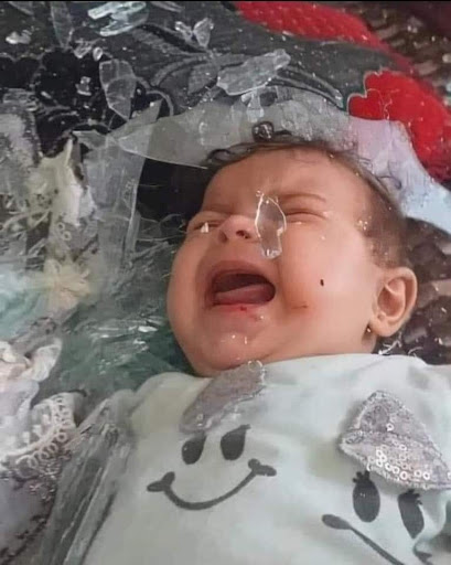 A baby injured in the strikes on the medical facility in the village of Sakina on August 17, 2021. (Image posted by Shingal Sinjar my city)