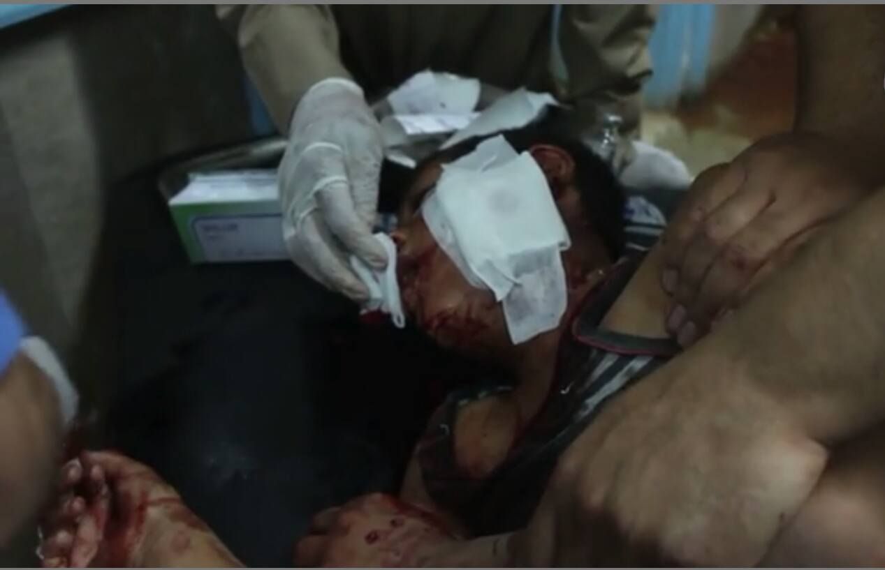 A wounded civilian being treated following an airstrike on Al Tabaqa (via RBSS)