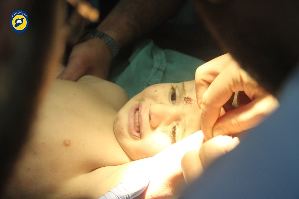 Baby Ahmad Al Rajab recovered from under the rubble after intense warplanes shelling on Al Sukkari neighborhood, Aleppo (via Aleppo White Helmets)