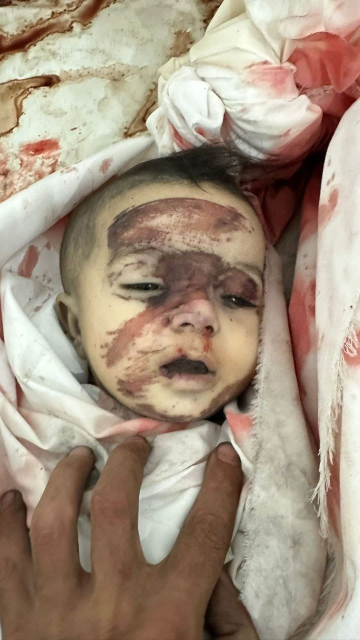 Source: Palestine pediatric patients service page