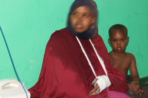 Civilian injured by alleged Kenyan airstrikes on Jilib on August 15, 2023. (Image posted by @xuquuqda1)