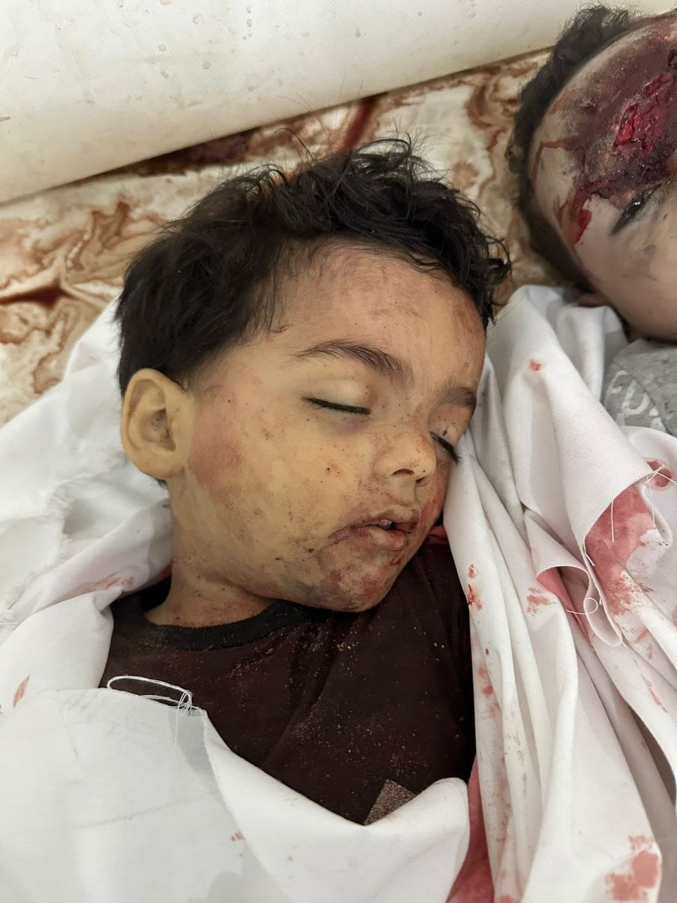 Source: Palestine pediatric patients service page