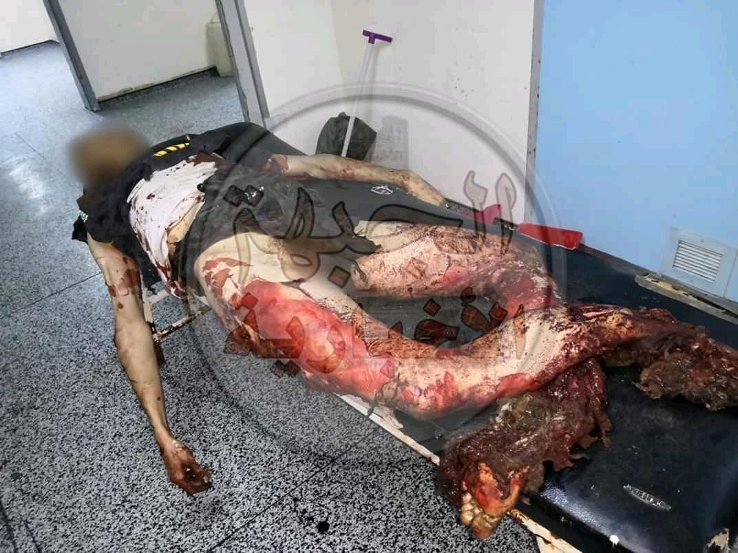 Victm of alleged GNA/Turkish strike on Qasr BIn Gashir on June 3rd, 2020 (via LibyanCom)