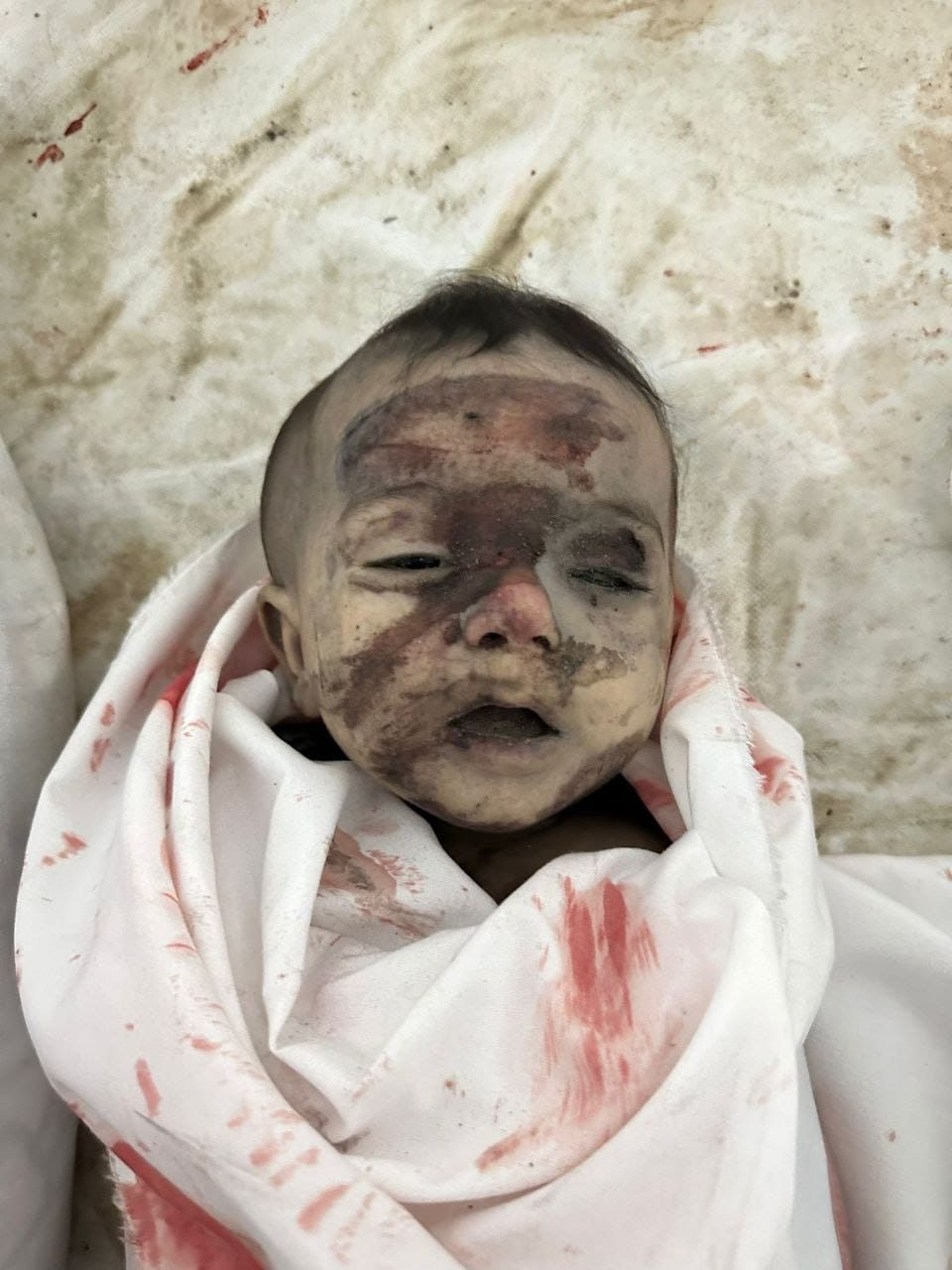 صفحة خدمة مرضي أطفال فلسطين
