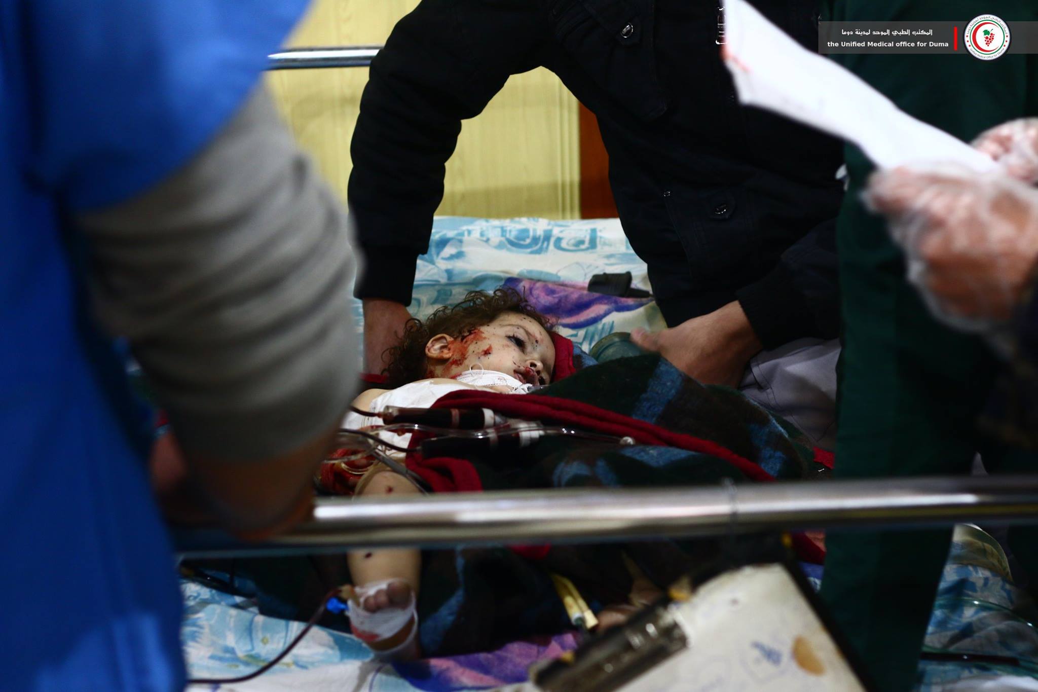 A child is treated in a medical facility following an alleged Russian airstrike on Douma, Feb 26th (via The United Medical Office for Douma)
